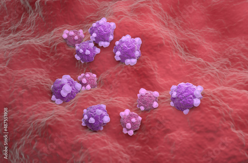 Ovarian cancer cell variations - isometric view 3d illustration photo