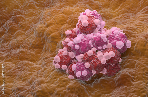 Ovarian cancer cell variations cluster - isometric view 3d illustration photo
