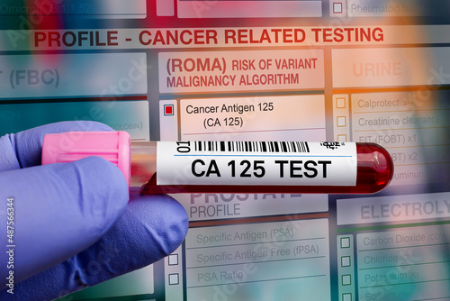 Blood tube test with requisition form for Cancer risk CA 125 ROMA test. Blood sample tube for analysis of Tumor Marker Risk Ovarian Malignancy profile test in laboratory photo