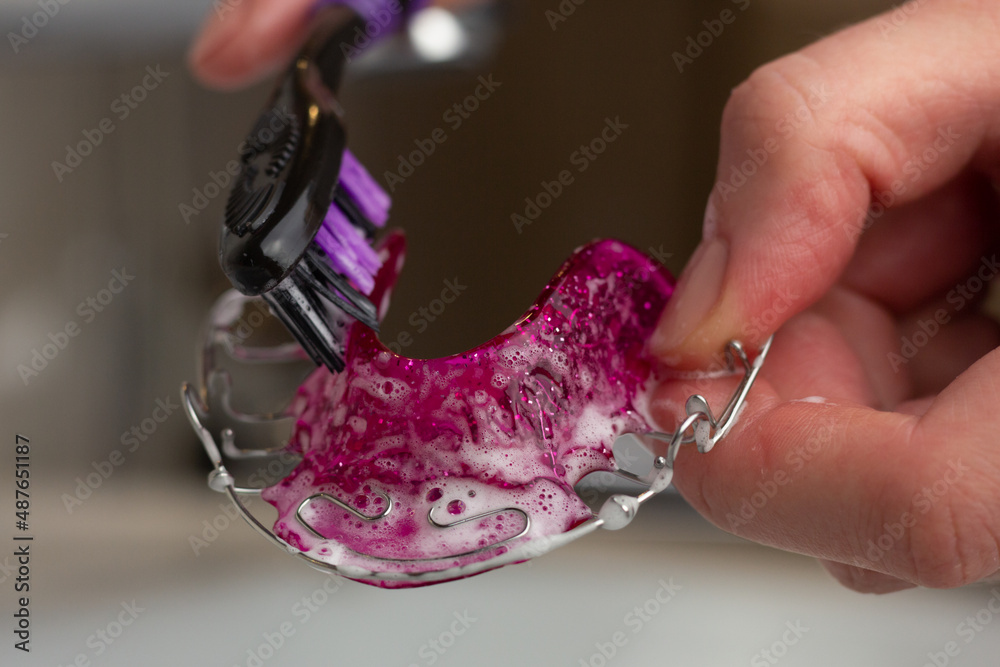 A woman is cleaning her removable Hawley retainer with a toothbrush.