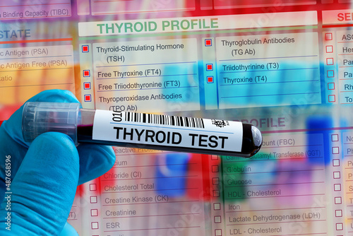 Blood tube test with requisition form for Thyroid hormone test. Blood sample tube for analysis of Thyroid hormone profile test in laboratory photo
