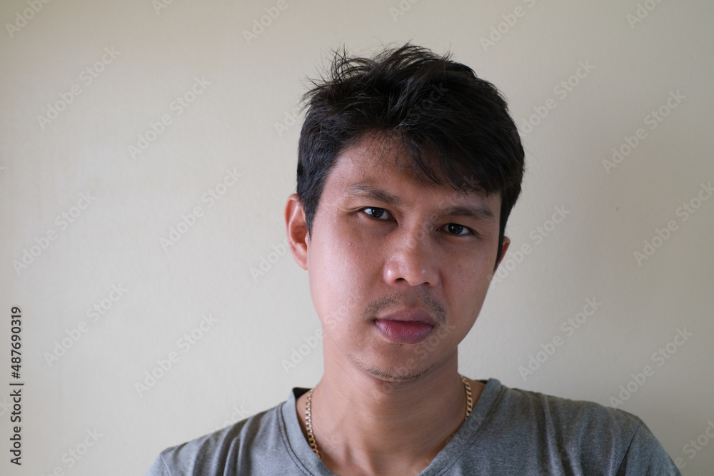 Teetch problem. Asian male with painful cheek swelling or dental abscess. A facial injury, tooth abscess, salivary stones, salivary gland tumor. Teetch problem. Asian male with painful cheek swelling or dental abscess. A facial injury, tooth abscess, salivary stones, salivary gland tumor.