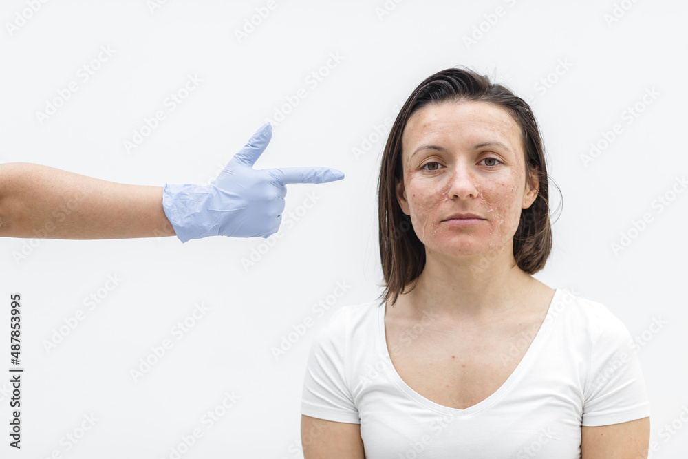 Close up photo of female face and hand in medical glove.