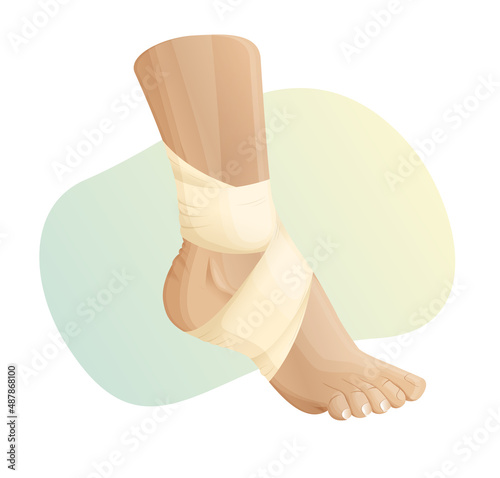 Elastic bandage for Ankle Sprain - Illustration