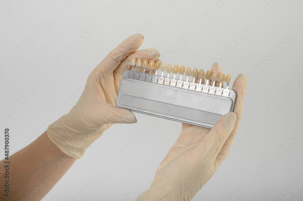 The doctor's hands hold a scale of tooth color shades The doctor's hands hold a scale of tooth color shades