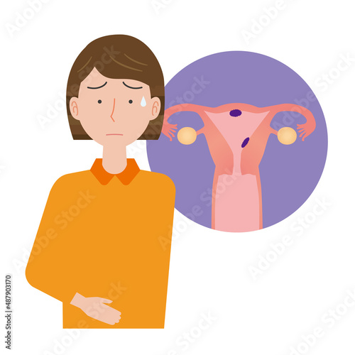子宮がんを心配する女性