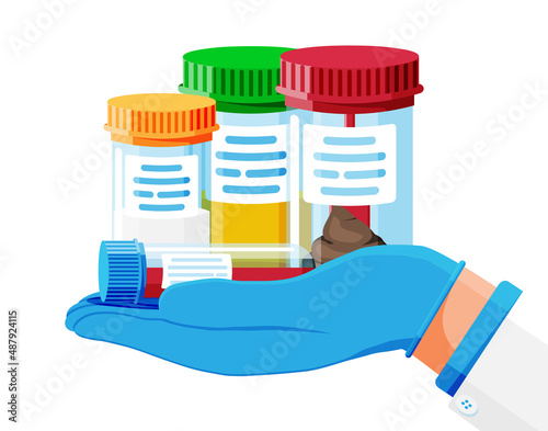 Test Tubes with Caps. Stool, Blood, Urine and Sperm. Medical Equipment. Specimen Cups for Gynecological Analysis. Plastic Containers with Biomaterial Analysis in Laboratory. Flat Vector Illustration
