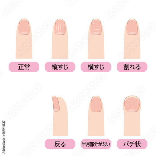 爪の状態と健康