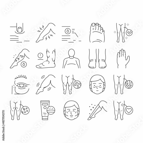 Edema Disease Symptom Collection Icons Set Vector .