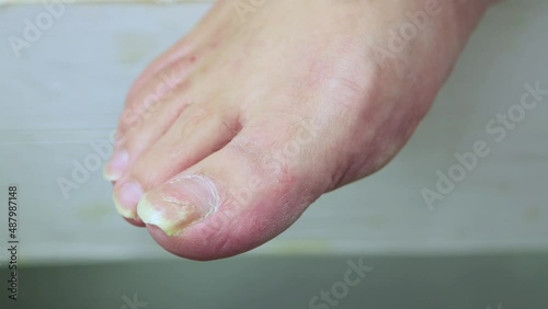 The big toe with the uncut toenail wiggles. We do the pedicure ourselves. Self-care for your feet. Isolated video, close-up. Warm, soft light. UHD 4K.