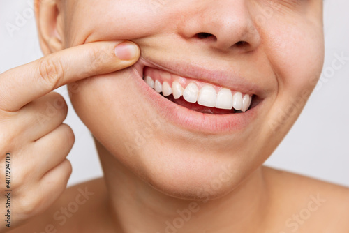 Gum health. Cropped shot of a young woman showing healthy gums. Dental care, dentistry concept