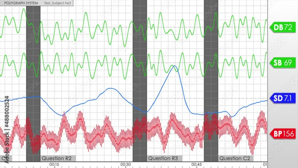 Polygraph Chart Size