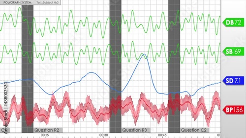  Polygraph test screen. Lie Detector. Polygraph Test. Examining Expert