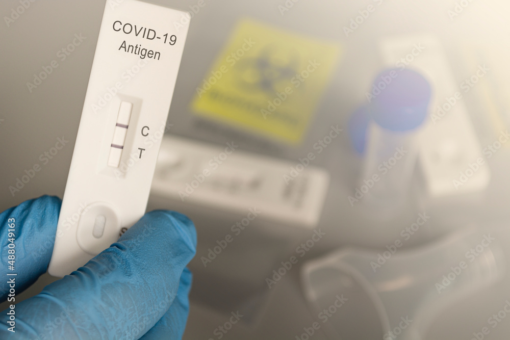 Doctor holding a Positive test kit for disease COVID-19.