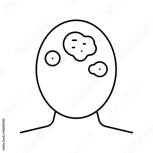 seborrhoeic dermatitis skin disease line icon vector illustration