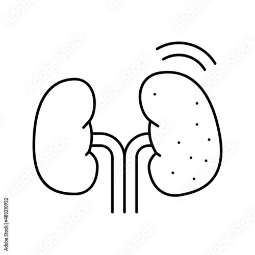 cancer kidney line icon vector illustration