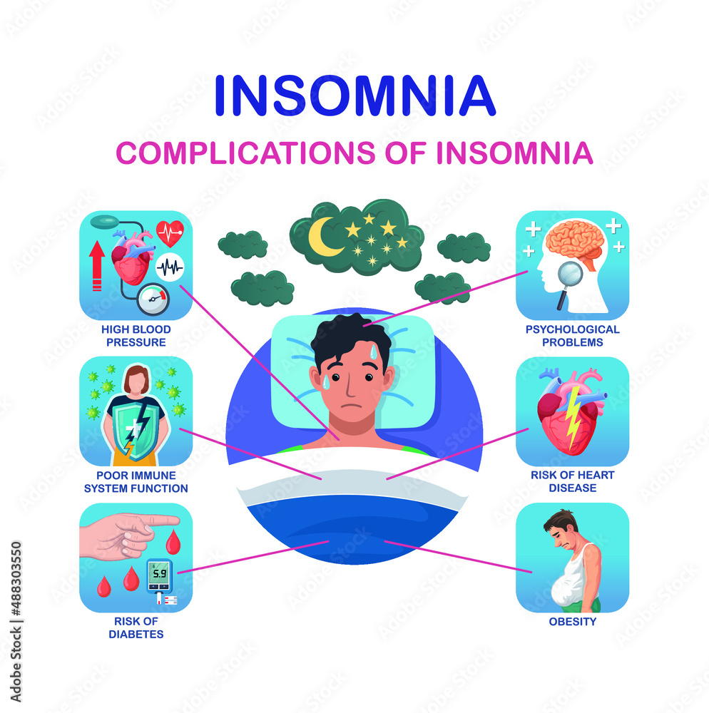 Insomnia complications and causes vector infographic. Insomnia complications and causes vector infographic.