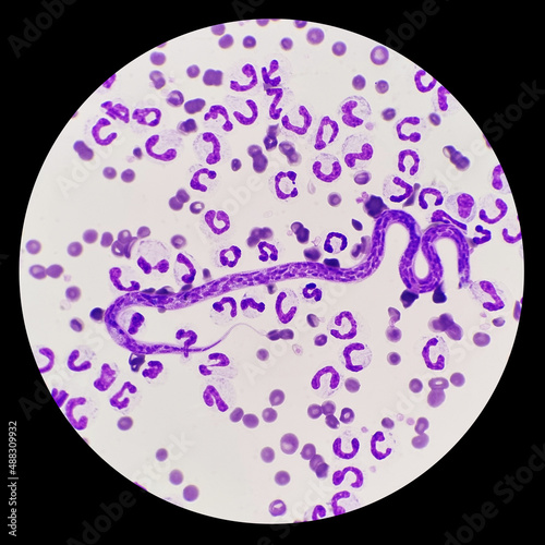 Microfilariae are not sheathed in the blood smear of a dog. Light microscope of heartworms, Dirofilaria immitis.