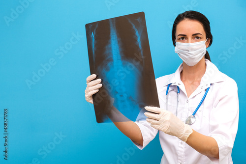 the doctor holds an X-ray of the spine in his hands, the patient has scaliosis.