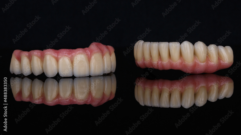 beautiful ceramic dental prostheses of the upper and lower jaws, filmed on black glass with creative reflection beautiful ceramic dental prostheses of the upper and lower jaws, filmed on black glass with creative reflection