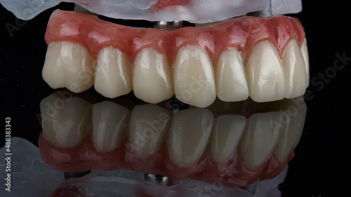 a beautiful angle on a dental prosthesis with artificial gums taken on black glass with reflection