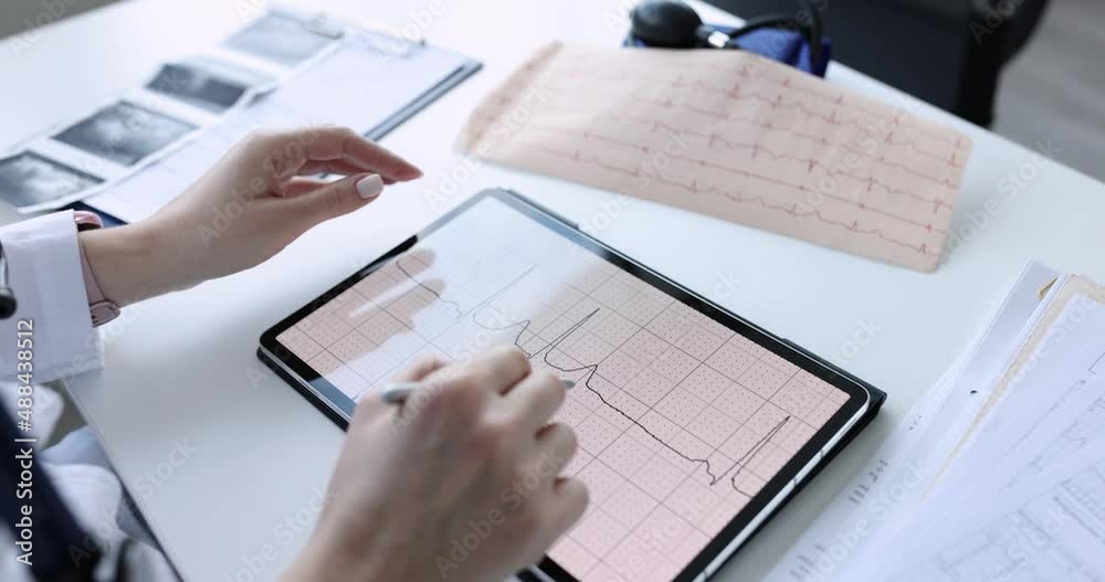 Doctor cardiologist studying ekg on digital tablet closeup 4k movie Doctor cardiologist studying ekg on digital tablet closeup 4k movie