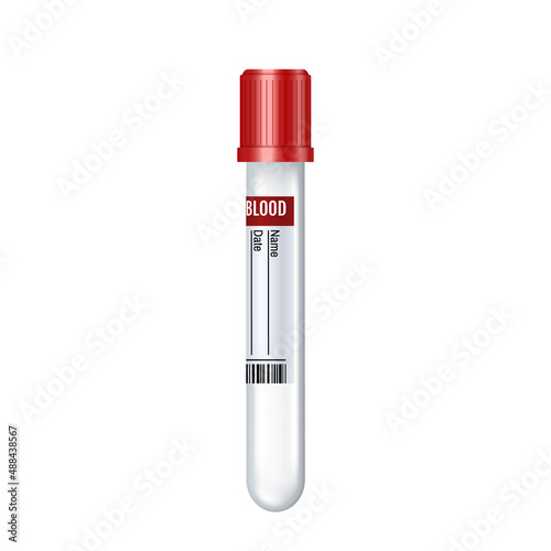 Realistic test tube with blood sample for blood donation and transfusion with sticker of donor