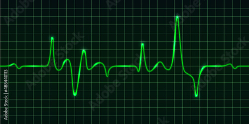 Heart beat pulse monitor, green electric wave signal, oscilloscope graph. Electrocardiogram line graph with light glow effect. Technology vVector illustration