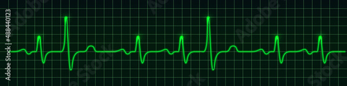 Heart beat pulse monitor, green electric wave signal, oscilloscope graph. Electrocardiogram line graph with light glow effect. Technology vVector illustration