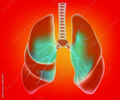 The illustration of lungs of cholera patients. This illustration can be used for medical and science materials. Vector illustration.