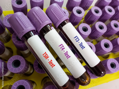 Blood sample for Thyroid panel hormone test for FT3, FT4, TSH with laboratory background. photo