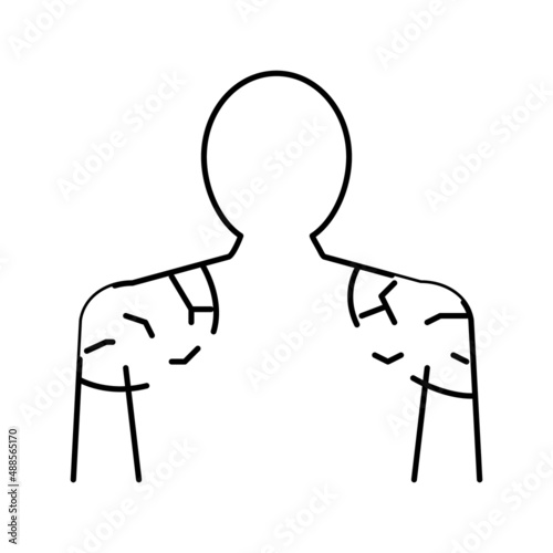 shoulders dry skin line icon vector illustration