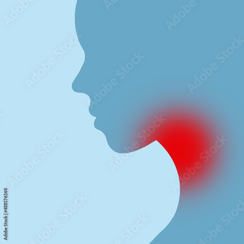 abstract illustration of sore throat photo