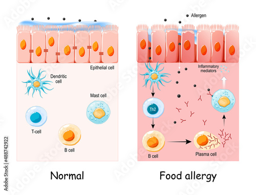 food allergy.  development of an allergic reaction photo