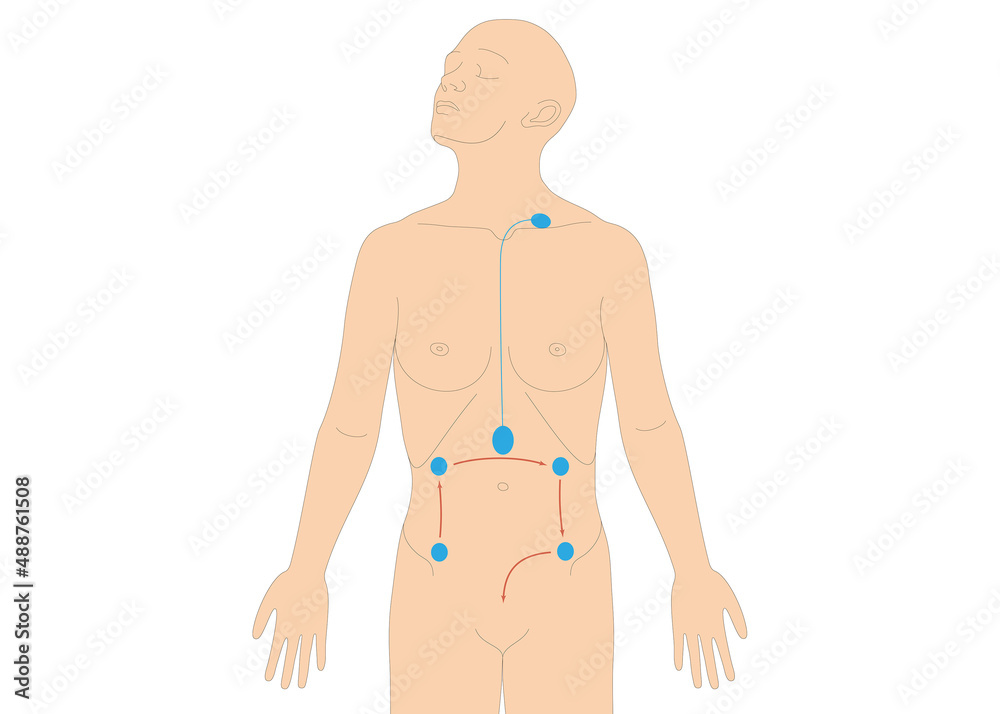 Ab Wann Lymphdrainage Nach Op stock.adobe.com