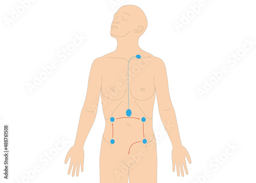 Infografik - Lymphdrainage am Menschen - Vorbehandlung am Bauch Colon