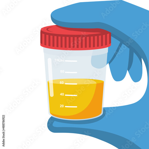 Urine analysis. The doctor in gloves holds jar with urine analysis. Test icon. Pee sample in plastic box. Medical sample in a glass tube. Laboratory container. Vector illustration flat cartoon design.