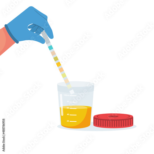 Urine analysis. Doctor in gloves holds an indicator strip in hands.Test icon. Pee sample in plastic box. Medical sample in a glass tube. Laboratory container. Vector illustration flat cartoon design.