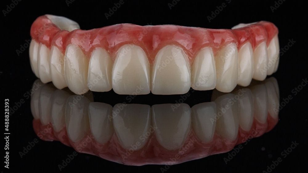excellent dental prosthesis with the gums of the upper jaw on black glass with reflection excellent dental prosthesis with the gums of the upper jaw on black glass with reflection