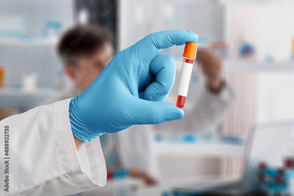 Scientist making test kit for viral disease COVID-19 Laboratory Scientist making test kit for viral disease COVID-19 Laboratory
