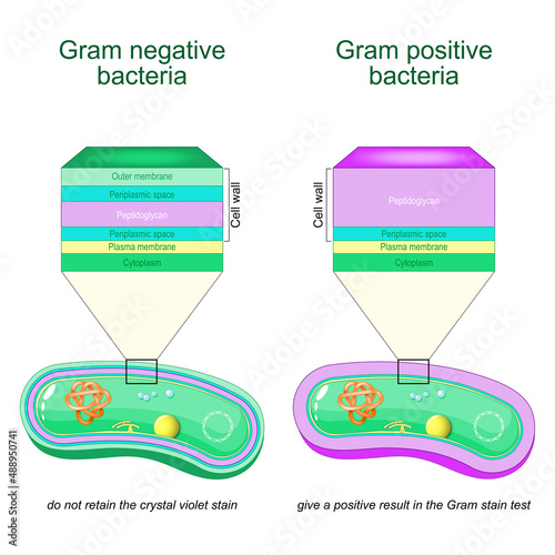 Gram negative and Gram positive bacteria