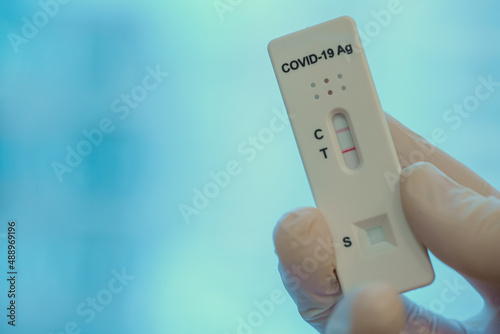 Virologist showing Positive Antigen Rapid Test for Coronavirus.