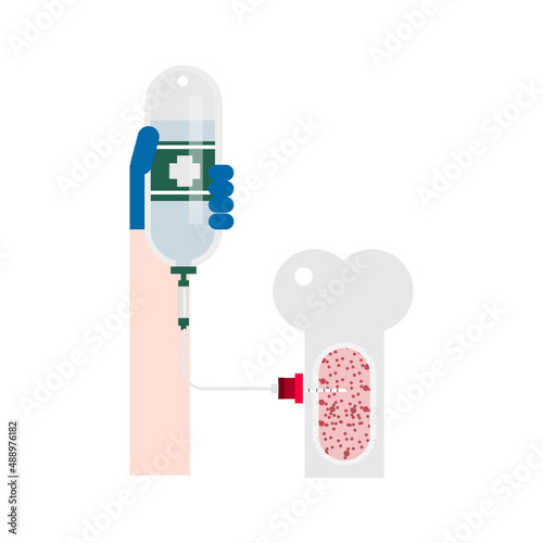 Intraosseous access procedure, needle through cortical bone and into the medullary cavity.