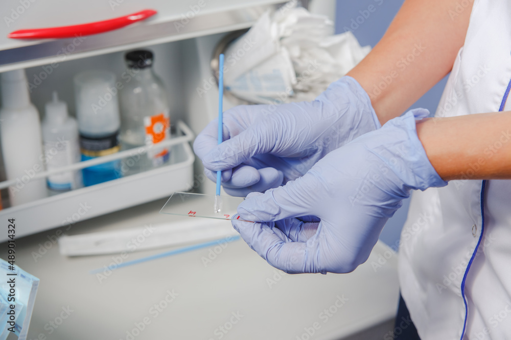 Close-up of doctor or nurse in protective gloves holding test glass