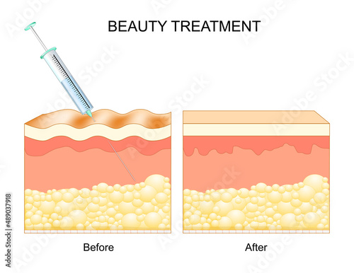 beauty treatment