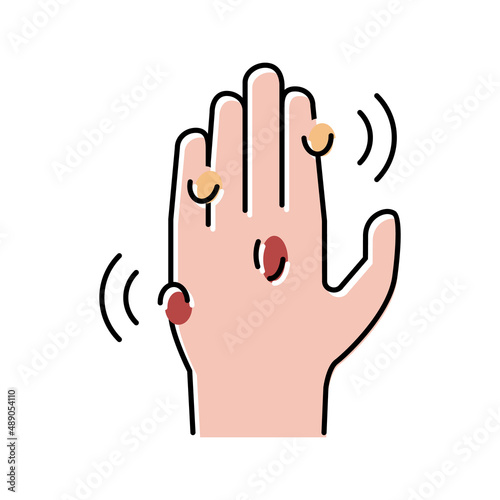 warts disease color icon vector illustration