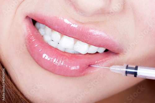 Beauty injections, lips and syringe