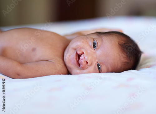 She wont let her birth defect get her down. Portrait of a baby girl with a cleft palate lying on a bed. photo