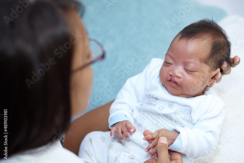 Finding comfort in the arms of her mother. Shot of a sleeping baby girl with a cleft palate being held by her mother.