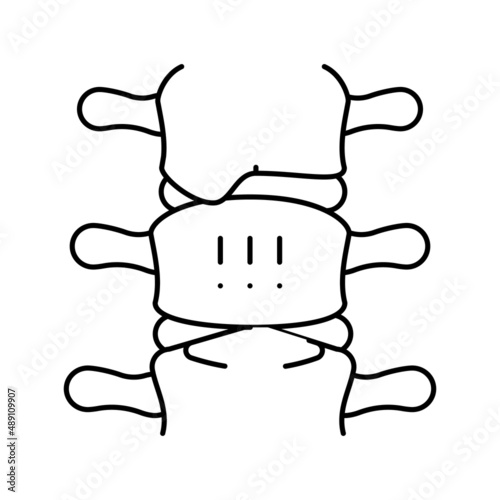 ankylosing spondylitis line icon vector illustration